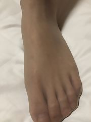Photo 5, Gf nylon feet (Nylon
